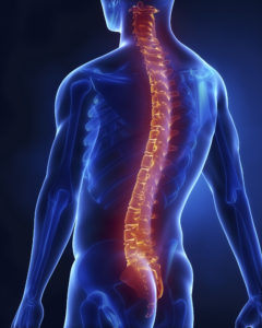 Denver spinal cord injury attorney